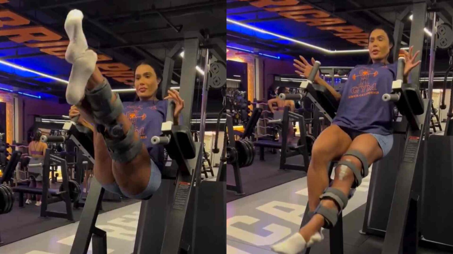 Gracyanne Barbosa é detonada por malhar com perna lesionada: ‘É doença’
